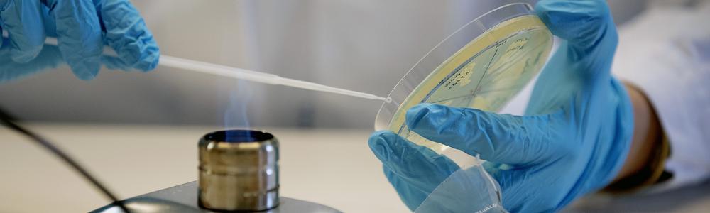 Hands holding a petri dish in front of a bunsen burner.