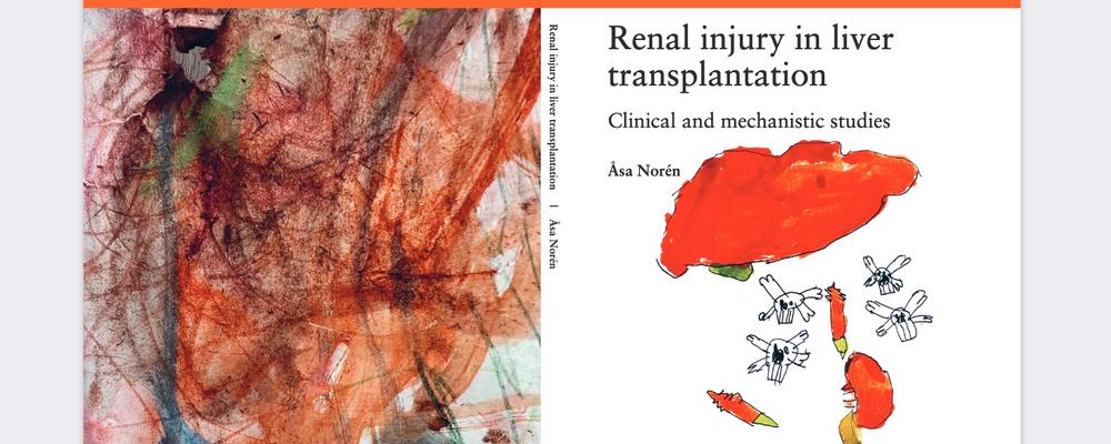 Cover illustrations – Front: Liver attack, by Arvid Norén. Back side - Graphic abstract by Ebba Norén