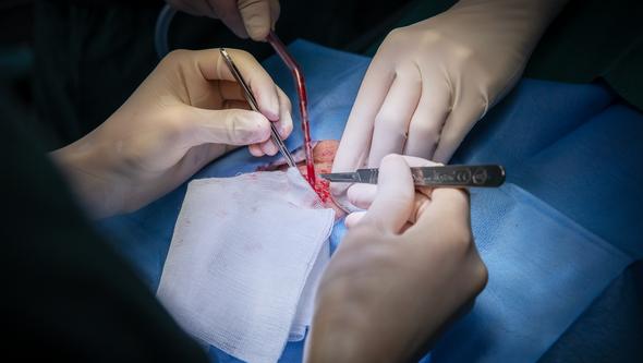surgery close up - two sets of hands in gloves with scalpels and a blood suction